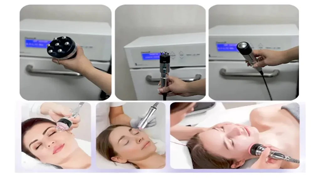لاغری با دستگاه کویتیشن Cavitation