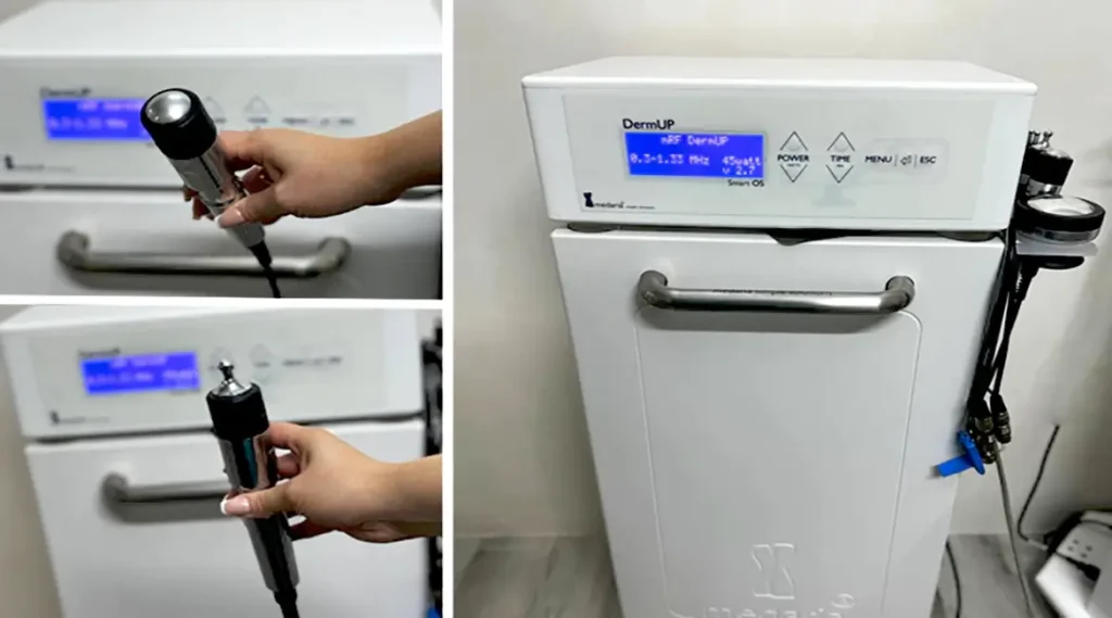 لاغری با دستگاه کویتیشن Cavitation