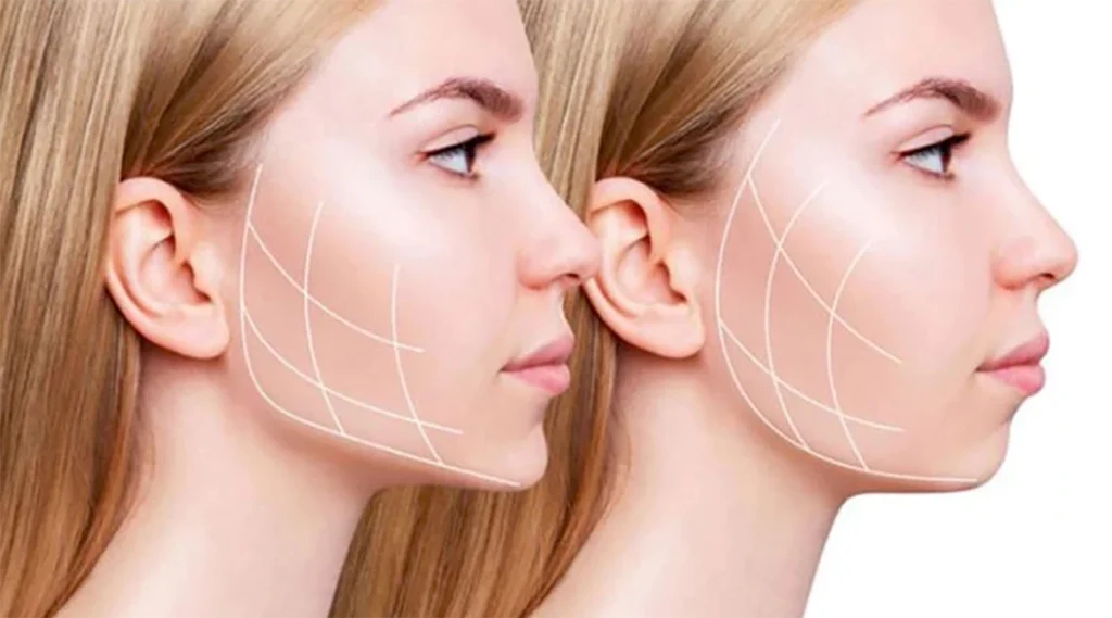 ۱۰ راهکار عالی برای لاغری صورت